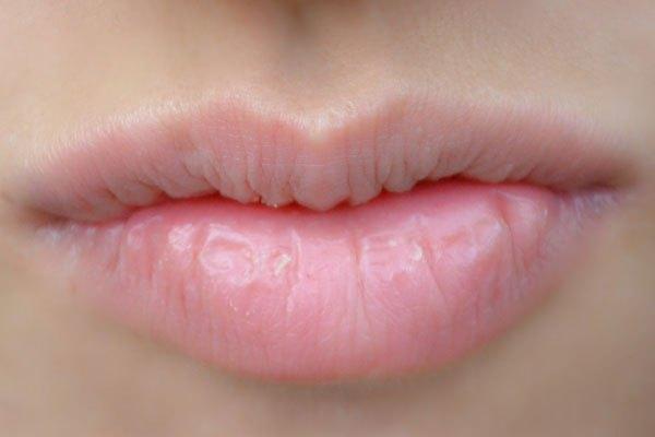 嘴唇顏色異常，其實是身體在給你「提醒」，這4種表現你要注意