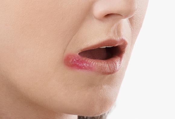 嘴唇顏色異常，其實是身體在給你「提醒」，這4種表現你要注意
