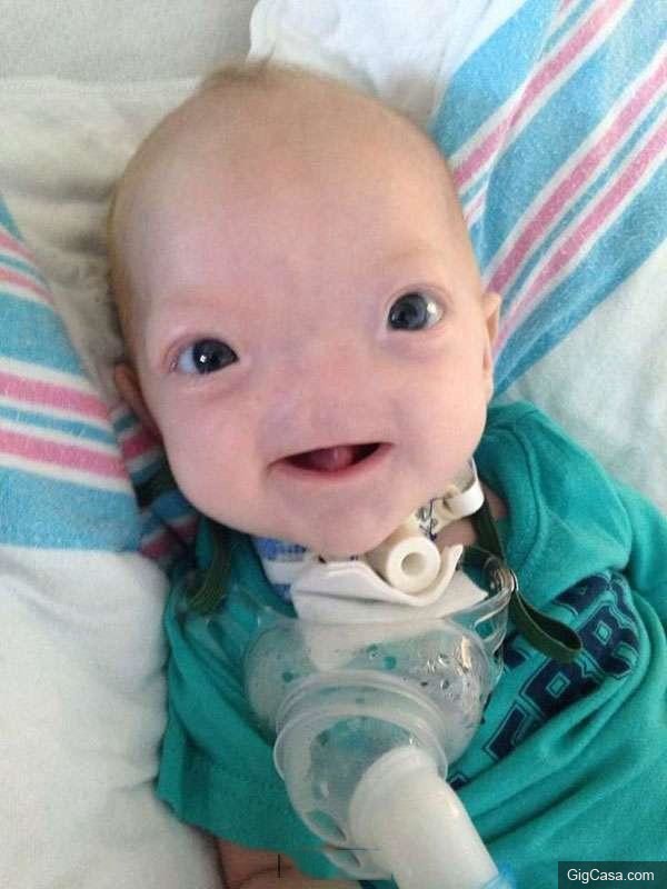 這個小嬰兒出生就沒有鼻子，但當他笑起來的時候你再難過也會忘記