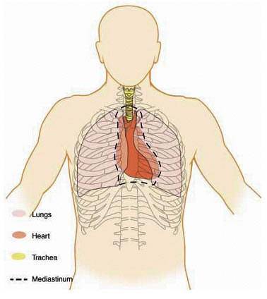 心脏与肺在胸腔内的毗邻关系(引自http/heart-valve-surgery.com.