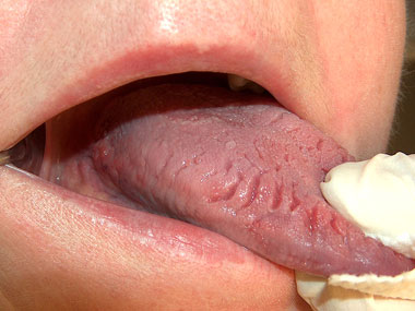 9種舌頭顏色讓你看出你搞不好早就已經罹患的「嚴重身體疾病」。