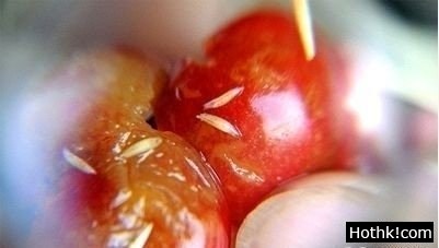你會吃櫻桃嗎？看完毛骨悚然，一定要知道的！（慎入）