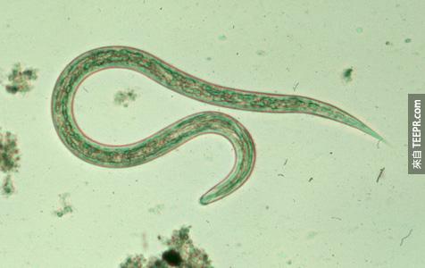 鉤蟲 （ Hookworm  ）– 這種可怕的吸血蟲會寄生在你的腸子裡面，並吸光你的血，讓你缺鐵。<BR><BR>