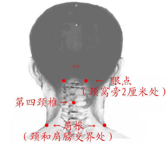 治疗颈部扭筋(落枕)的穴位及指压法   在颈窝旁2厘米处的"眼点"
