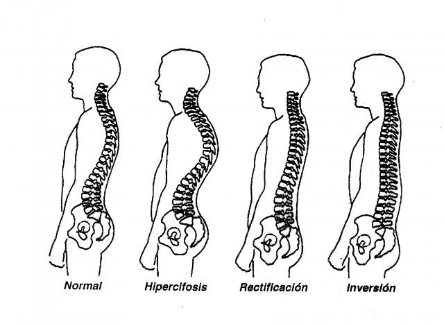 健康脊椎是人的命根,很简单不妨试试看!