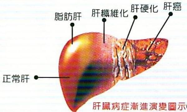 伯伯得了肺癌！被宣告已經無法治療！回到家裡實行『鮮汁療法』把癌細胞給喝掉了!