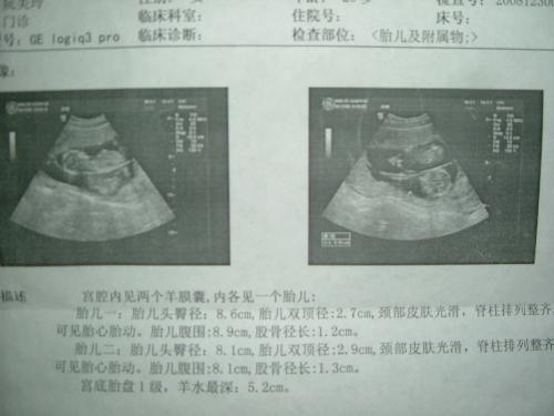 她為愛不認父母，多次墮胎後被告知再也不能懷孕，她的丈夫竟然做了這件事...