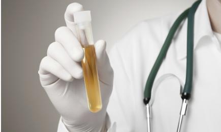 從尿液中就能看出肝臟是否健康？