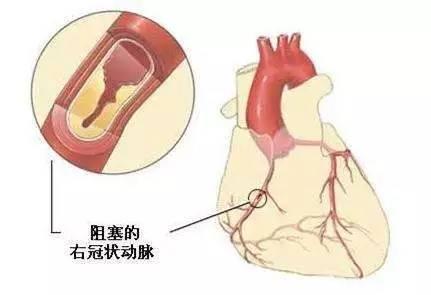 神奇！按一按，竟然能對付人類健康的「第一殺手」