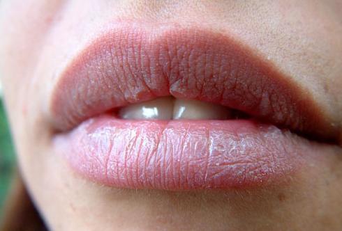 嘴唇這6種狀態暗示身體的「6種問題」，第4種最嚴重，特別是女性······