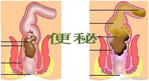 蜂蜜加它一起吃，對便秘有奇效，效果顯而易見，不信你試試