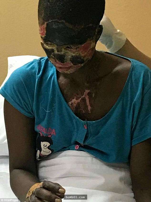 她一看到消失的丈夫突然现身眼前「下一秒脸上就感觉被火烧」,她死也