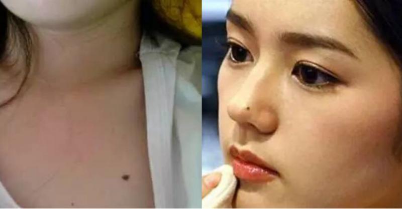 【命理解析】女人不想婚姻不幸,财运不济,一定要去掉这9颗「霉运痣」!