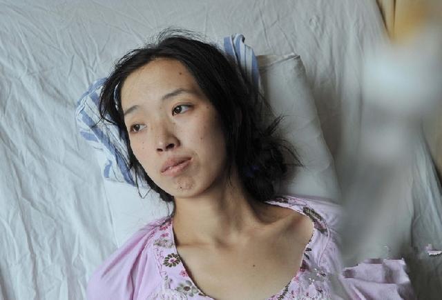 不抽烟,不喝酒,肠癌为何缠上她?