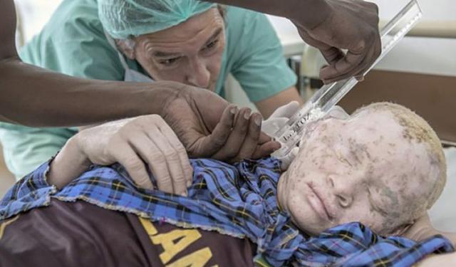 世界上最「贵」的人,皮肤比黄金还贵,经常担心被猎杀