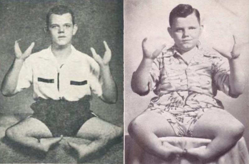 畸形男「用龙虾手撕裂妻子下体」,法庭上装无辜:「我有残疾监狱不能关