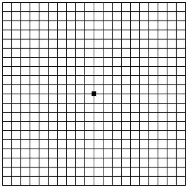 阿姆斯勒方格表是什么图片