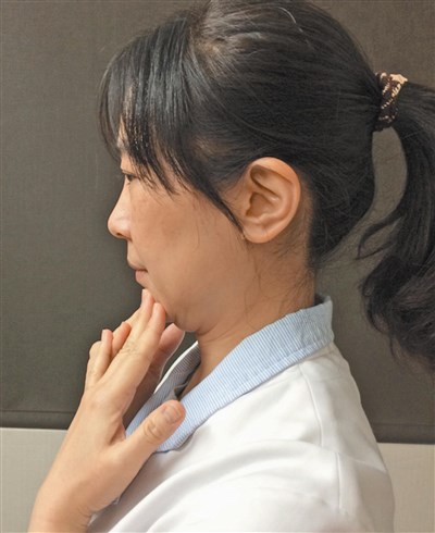 總愛轉脖子發出「喀喀2聲」放鬆?小心一扭全身癱瘓.