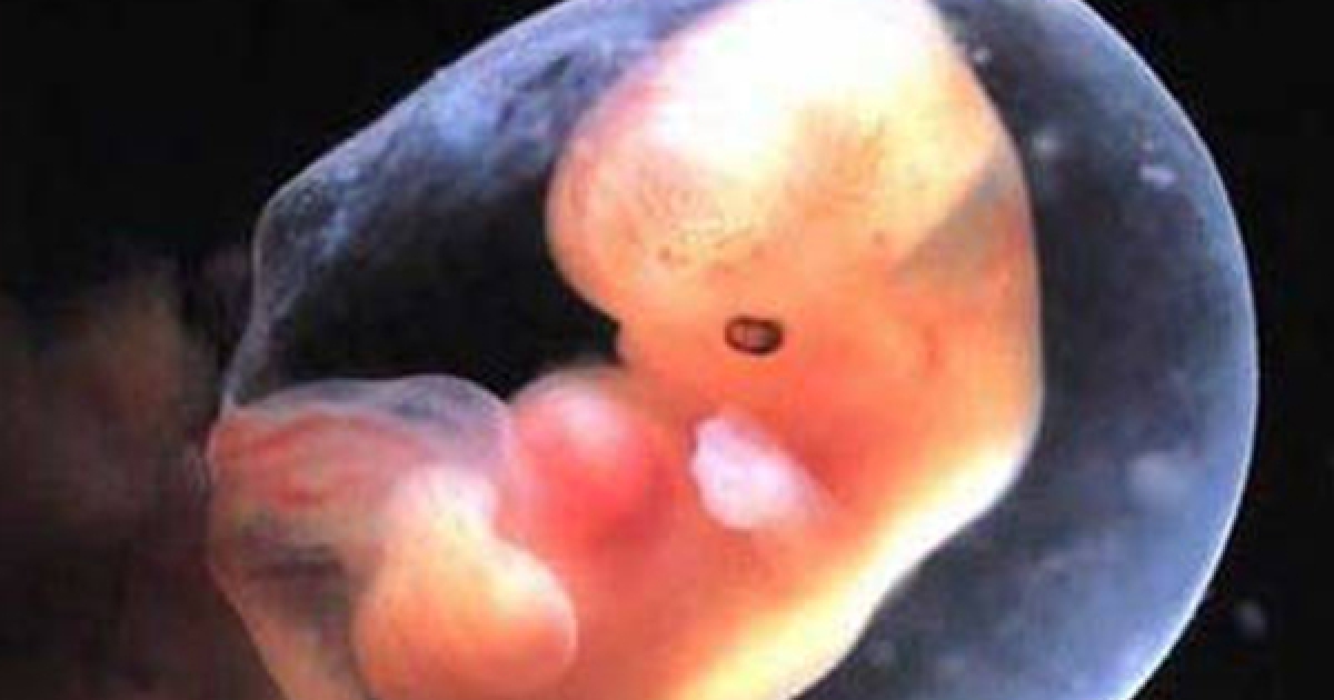 胎儿八周有多大图片图片
