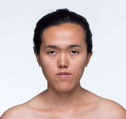 戽斗妹许愿「我想有正常人的脸」 改造完成变混血正妹美翻天