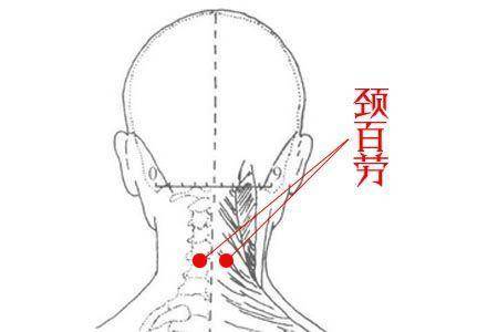 颈部肌肉疼痛,按摩经外奇穴,颈百劳