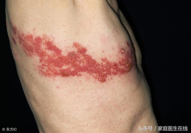 警惕!身上出现这四个疼痛特点,「不死的癌症」找上你了