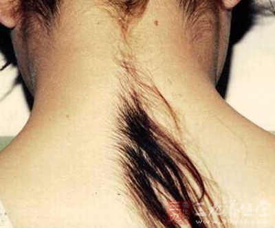 不管男女,这里长毛,那你这辈子就倒楣了!