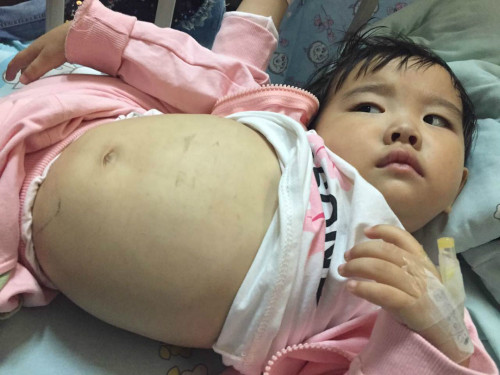 三岁女童不知身患何病,肚胀如孕妇,疼地直喊妈妈,年轻妈妈心都碎了