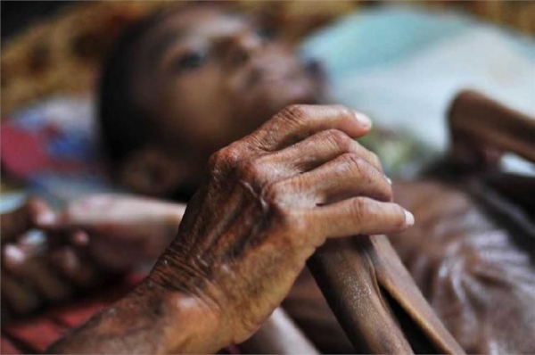 17岁「活骷髅」少年吓跑父母,88爷爷数十年如一日照顾!