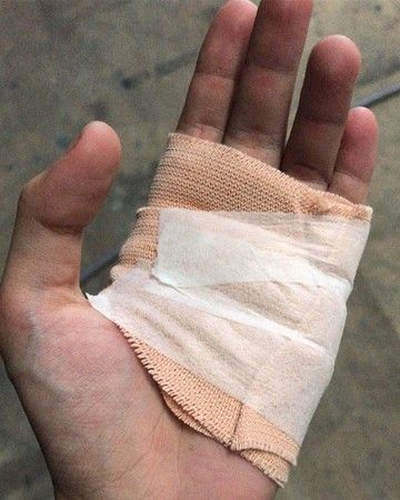 (在变强壮之前必须受点伤)」照片中,她的左手手掌整个被绷带包扎起来