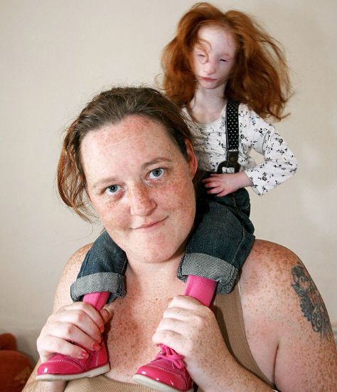 「世界最小女孩」出生就被断定活不下去 现在开始上学过缩小版人生