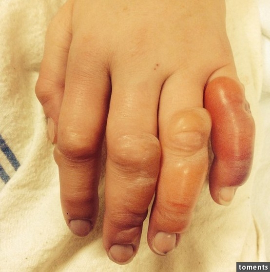 年轻貌美的漂亮正妹喝醉躺在野外过了一夜,没想到这