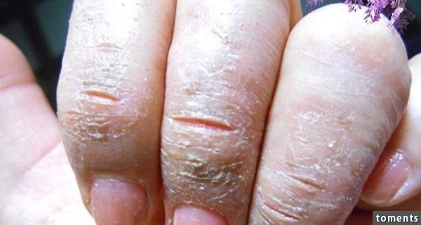 冬天不能这样洗澡,否则皮肤又乾又痒,还可能皲裂!