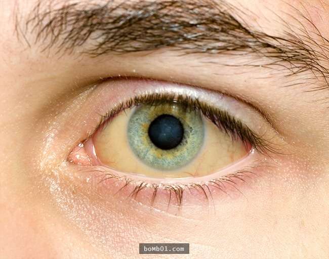 如果你的眼睛現在「看到這樣子的畫面」代表健康有問題，請你一定要馬上去檢查雙眼！