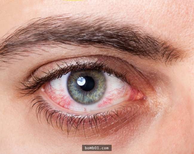 如果你的眼睛現在「看到這樣子的畫面」代表健康有問題，請你一定要馬上去檢查雙眼！