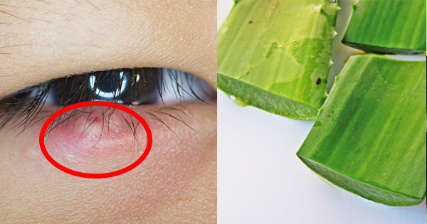 简单5招「杀菌,消炎,止痒」!