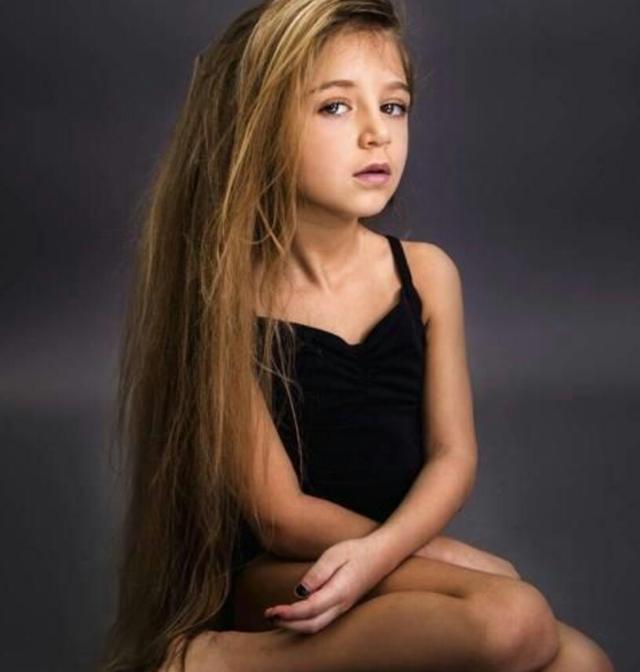 这位俄罗斯6岁女孩美若天仙,但是「脱掉上衣后」让众人都唏嘘不已.