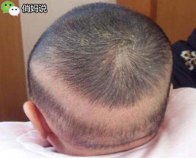 藏在寶寶身上的7個「小秘密」,無數爸媽至今不知道真相!