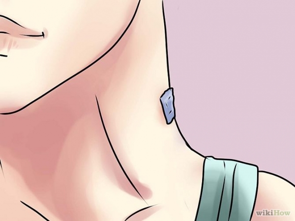 Remove a Skin Tag from Your Neck Step 12.jpg