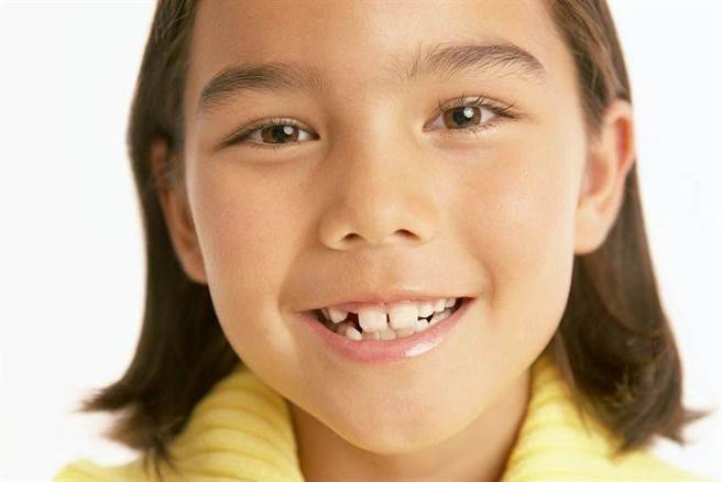 孩子會經歷一段換牙期(圖/TUPIAN)