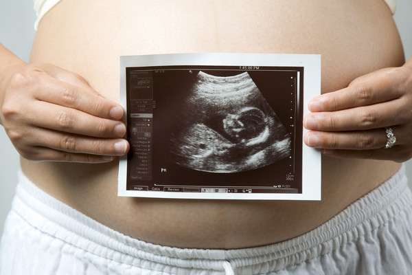 孕媽咪最常問的16個「超音波」問題！名醫一次解答