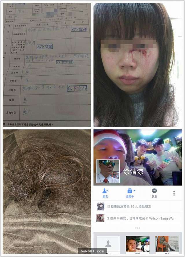 「行動KTV」司機被年輕女友上傳各種證據控訴遭痛毆，許多人看到頭髮的照片時都怒喊要揍他一頓！