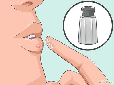如何用鹽和茶包治療皰疹？