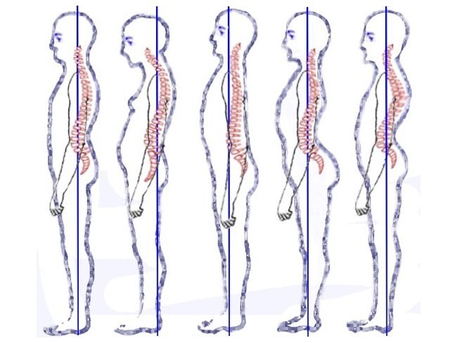 「脊椎」人一生的命根，若是歪了就全毀了！這些動作我試了一週脊椎就挺了，舒適萬分！
