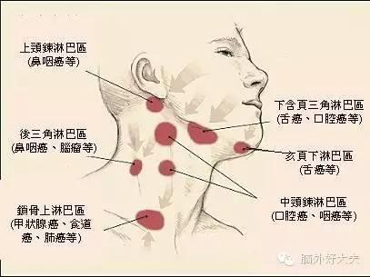 脖子長小肉粒是怎麼回事