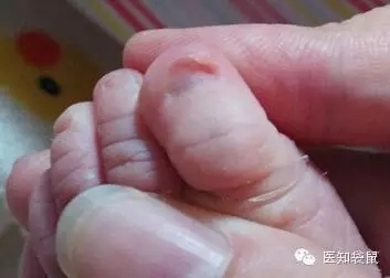 這樣給寶寶剪指甲的父母們，看看你錯在了哪？