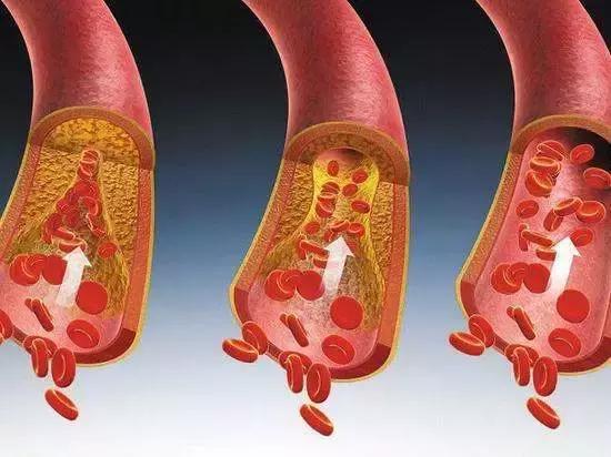 血管堵沒堵，抬腳便知！1個動作6種食物讓全身血液暢通