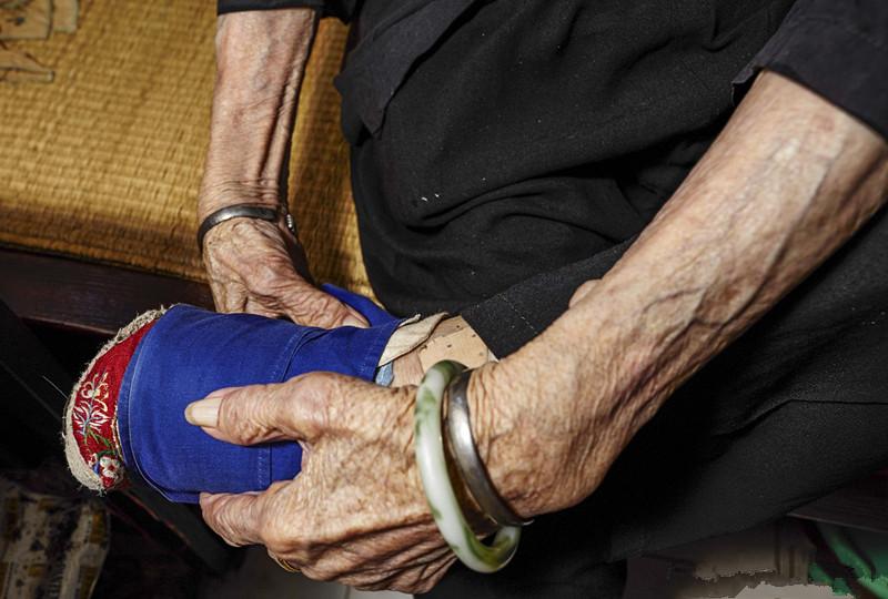 她從「5歲開始裹小腳」到現在100年過去卻從沒看過自己的雙腳，沒想到打開的瞬間讓所有人都心碎了！