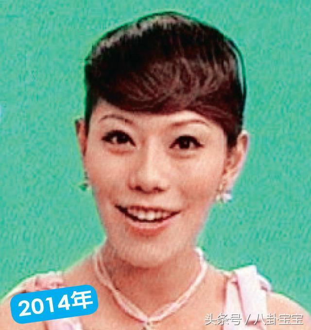 她是模特兒出道，21年來堅持整形「60次」，她終於從「醜八怪」變成韓劇女主角！