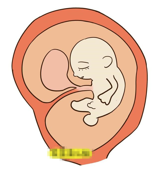 不想讓寶寶身上有胎記，從孕期就要開始預防了！